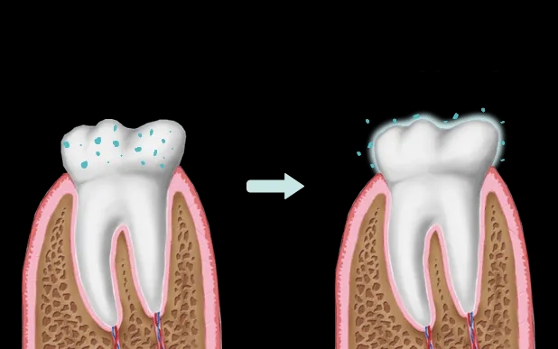 Objawy niedoboru fluoru: jak rozpoznać zagrożenie dla zdrowia zębów