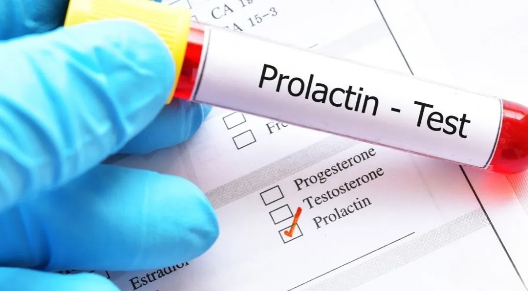 Badanie prolaktyny w którym dniu cyklu - klucz do dokładnych wyników