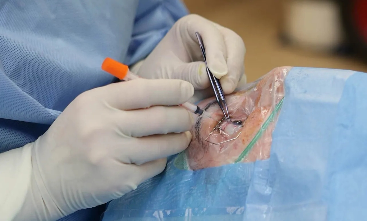 Skutki uboczne Avastinu: prawdziwe doświadczenia pacjentów na forum