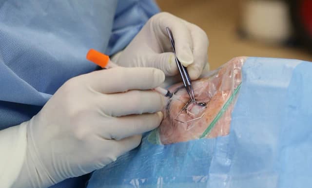 Skutki uboczne Avastinu: prawdziwe doświadczenia pacjentów na forum Skutki uboczne Avastinu: prawdziwe doświadczenia pacjentów na forum