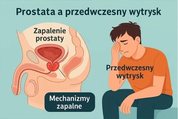 Jak wyleczyć zapalenie prostaty - skuteczne metody i porady