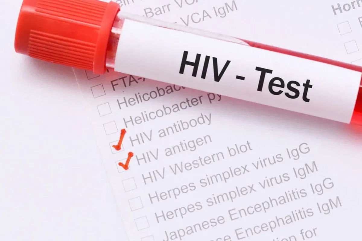 HIV po jakim czasie badania? Dowiedz się, kiedy test jest wiarygodny