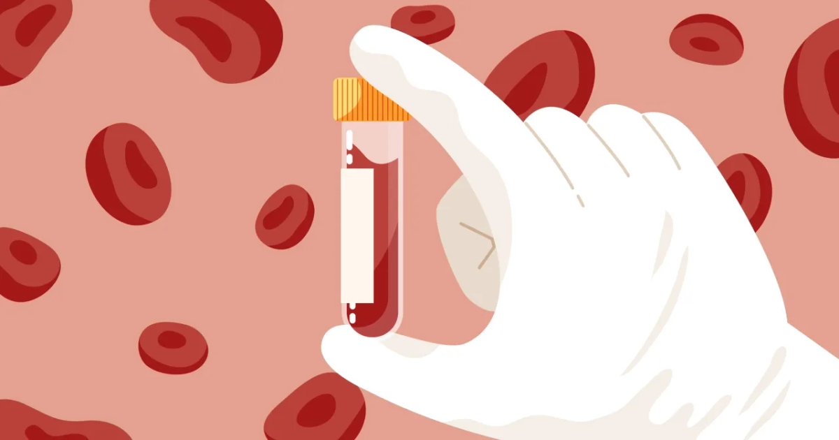 Podwyższony poziom kwasu moczowego: przyczyny, objawy i skuteczne leczenie