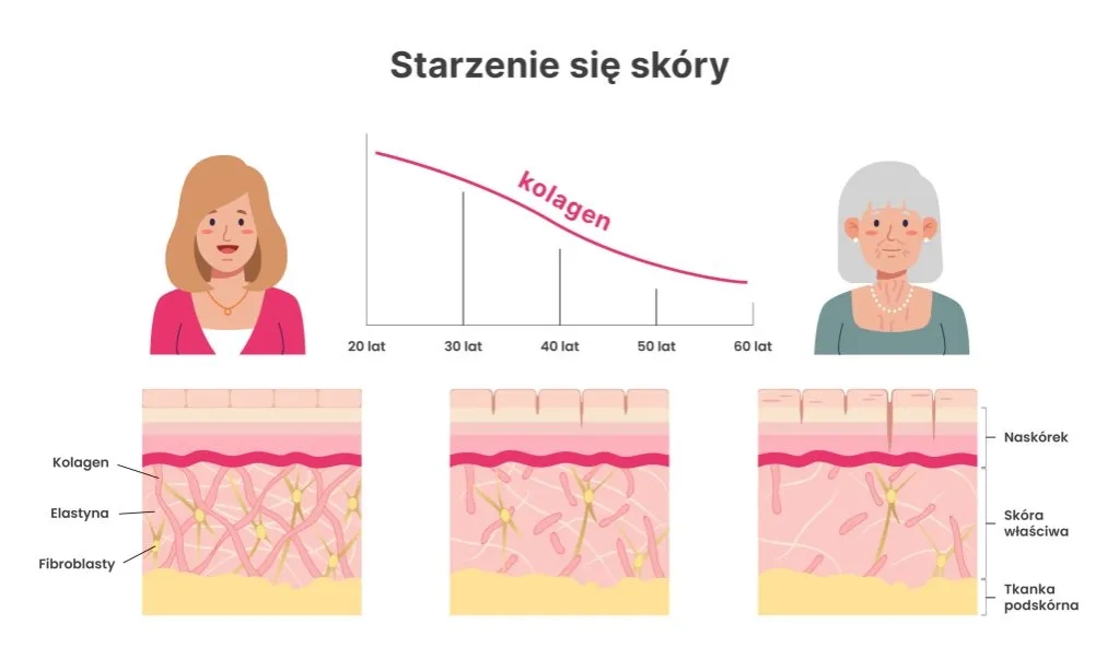 Niedobór kolagenu objawy: jak rozpoznać skutki braku kolagenu