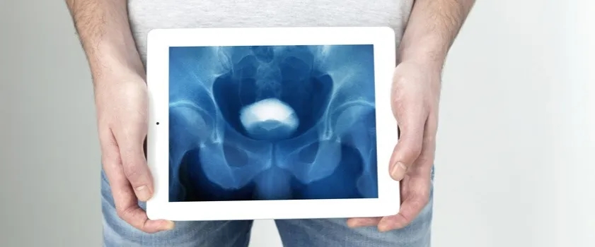 Jak zapobiec prostacie i uniknąć poważnych problemów zdrowotnych