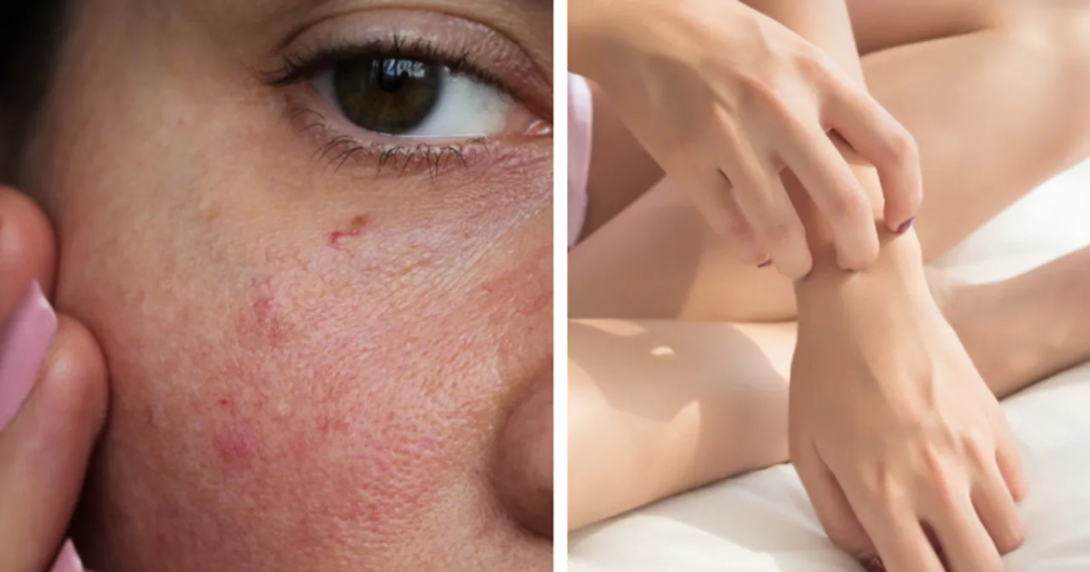 Objawy niedoboru wit D: Jak rozpoznać i uniknąć poważnych skutków